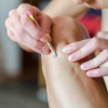 Ingrown hairs?