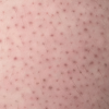Strawberry skin?