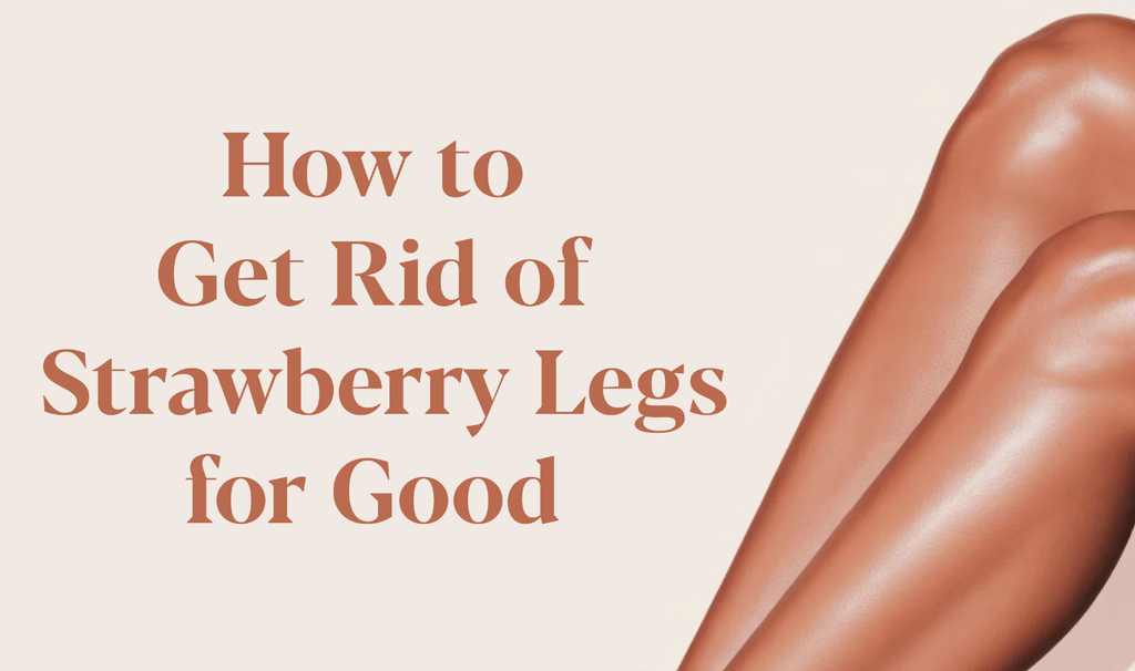 How To Get Rid Of Strawberry Legs For Good